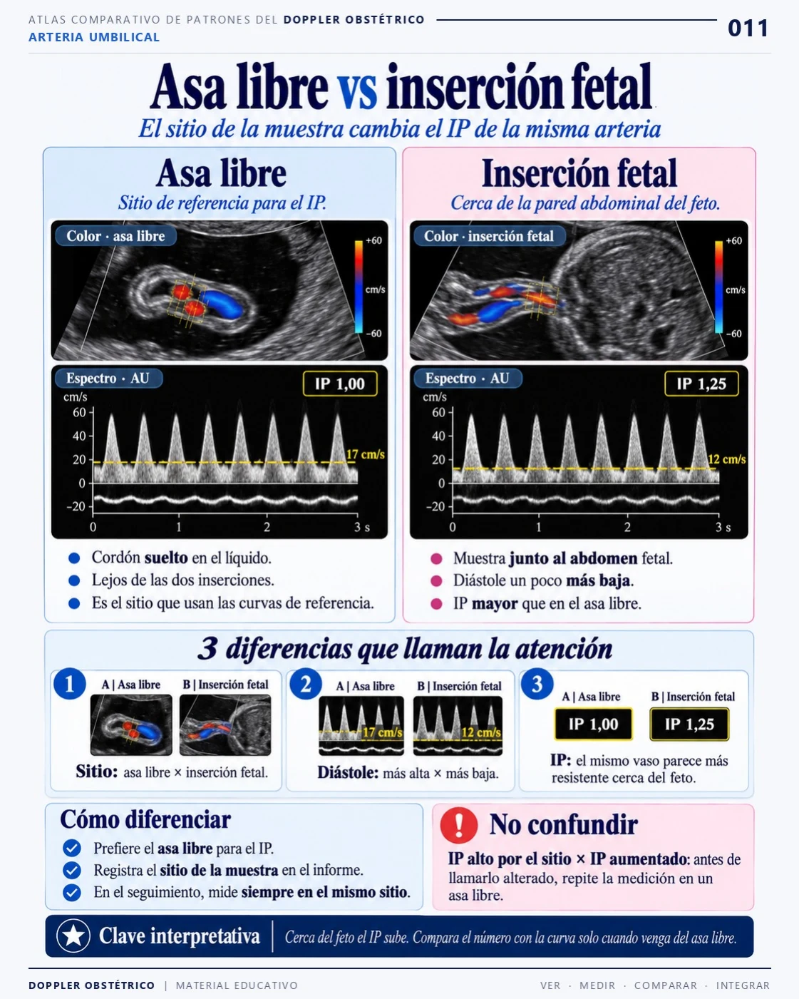 Página 11: Asa libre e inserción fetal. Extracto del PDF de Doppler Obstétrico y Fetal.