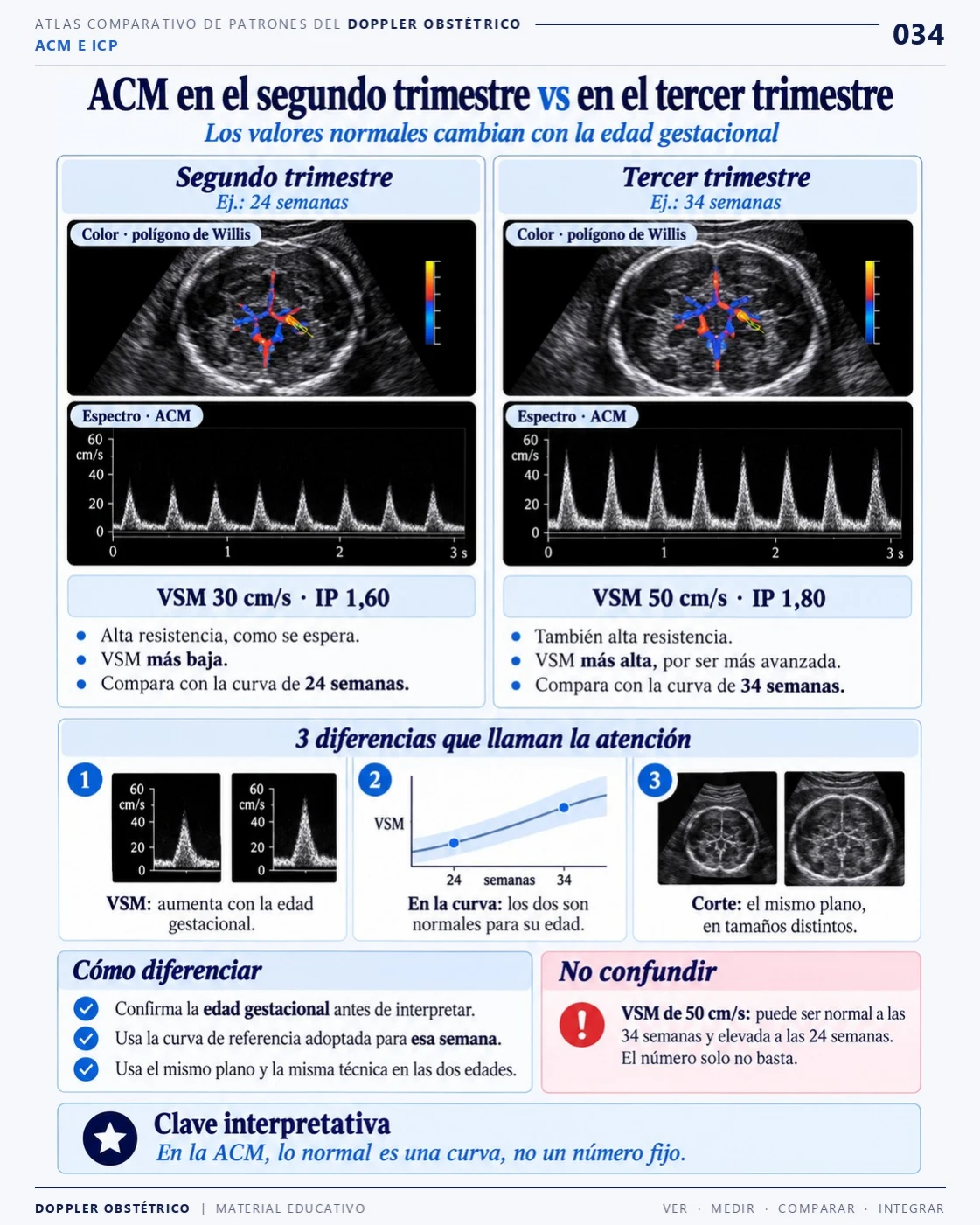 Página 34: ACM en el segundo y tercer trimestre. Extracto del PDF de Doppler Obstétrico y Fetal.