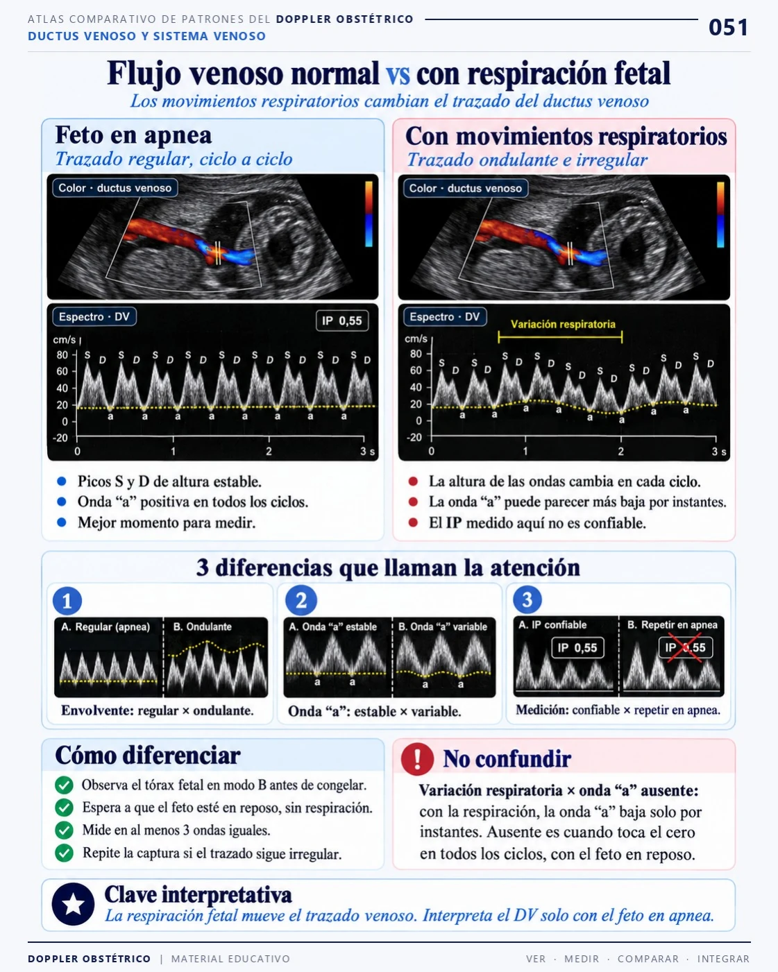 Página 51: Flujo venoso y respiración fetal. Extracto del PDF de Doppler Obstétrico y Fetal.