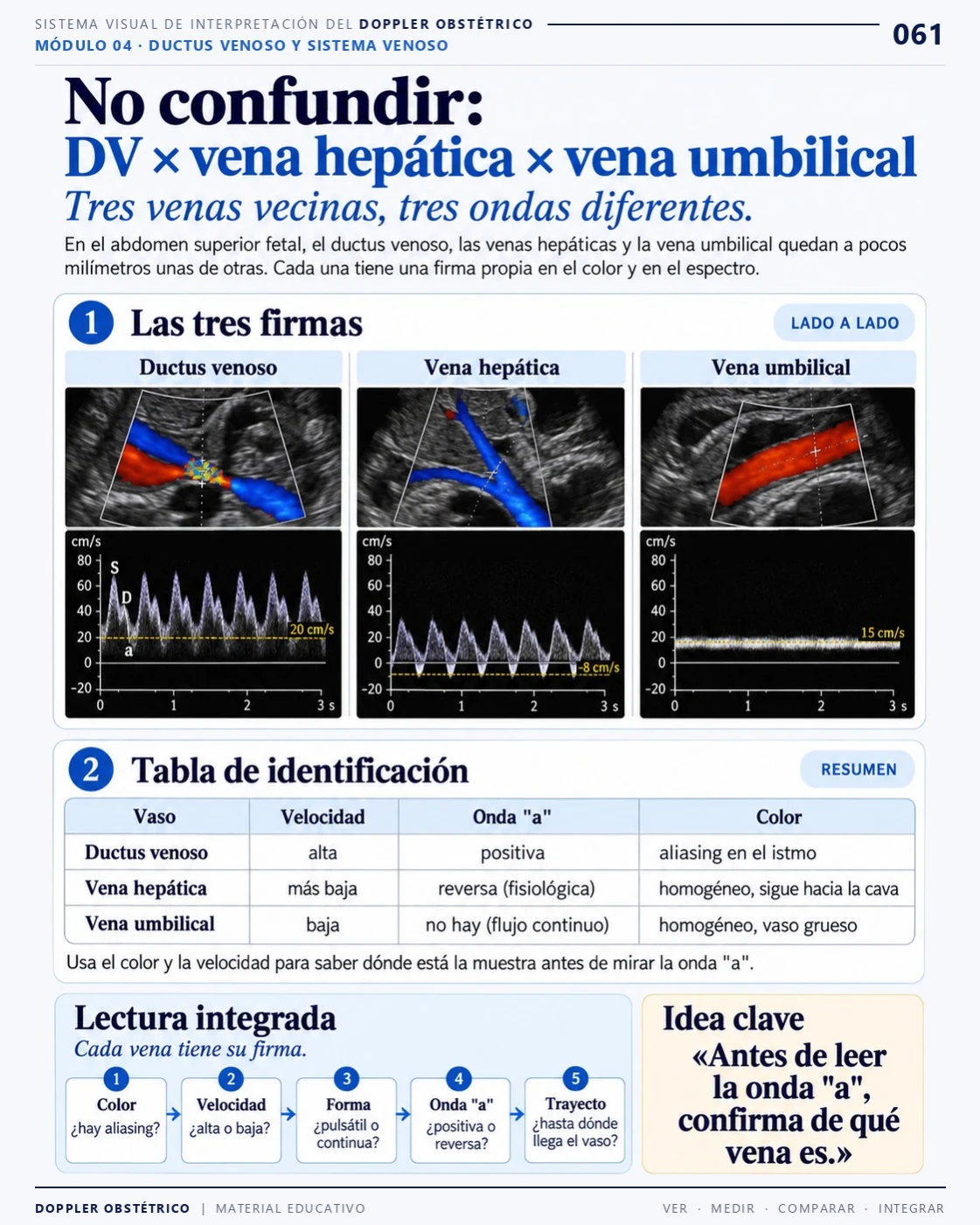 Página 61: Ductus venoso, vena hepática y vena umbilical. Extracto del PDF de Doppler Obstétrico y Fetal.